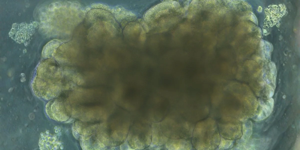 Закрита система. Вчені розробили маленькі мозкові структури та навчали їх справлятися з інженерними завданнями.