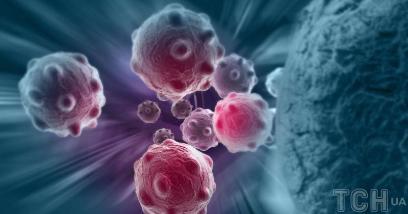 У сусідній державі виявили недугу, що викликала спотворення у людей у середньовічний період.